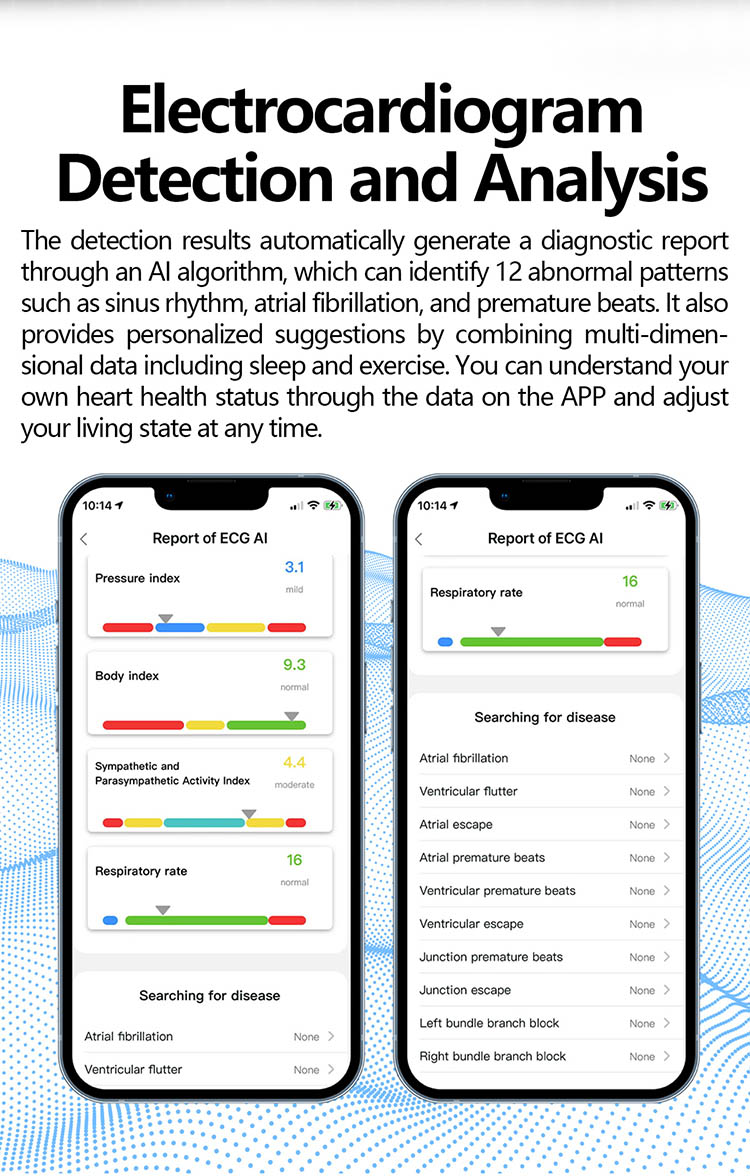 q520 Ecg Smart Health Ring